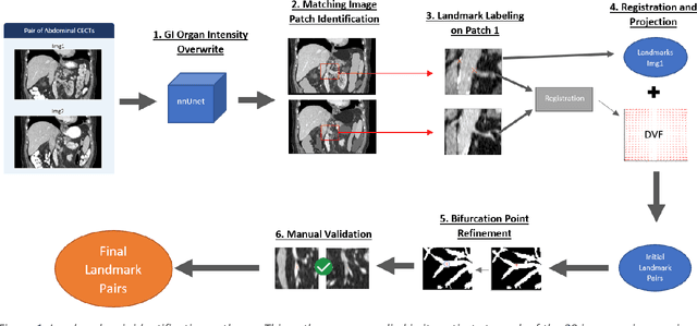 Figure 1 for A Vessel Bifurcation Landmark Pair Dataset for Abdominal CT Deformable Image Registration (DIR) Validation