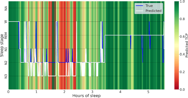 Figure 4 for Bridging AI and Clinical Practice: Integrating Automated Sleep Scoring Algorithm with Uncertainty-Guided Physician Review