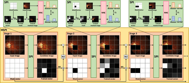 Figure 2 for Hierarchical Salient Patch Identification for Interpretable Fundus Disease Localization