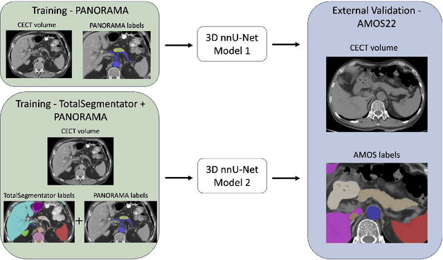 Figure 1 for Leveraging Anatomical Priors for Automated Pancreas Segmentation on Abdominal CT