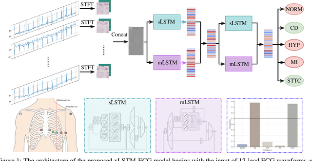 Figure 1 for xLSTM-ECG: Multi-label ECG Classification via Feature Fusion with xLSTM