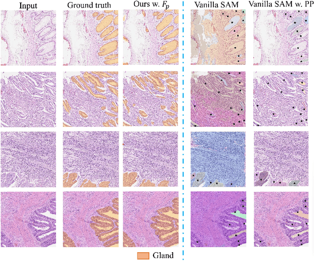Figure 2 for SAM-Path: A Segment Anything Model for Semantic Segmentation in Digital Pathology