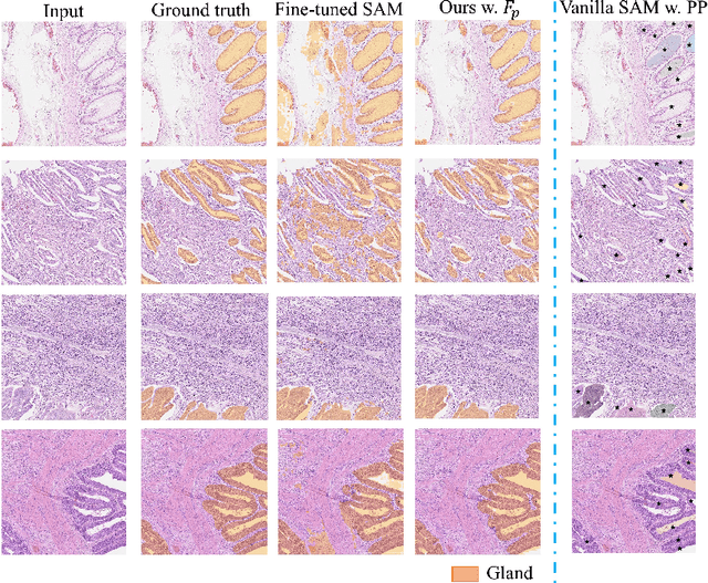 Figure 4 for SAM-Path: A Segment Anything Model for Semantic Segmentation in Digital Pathology