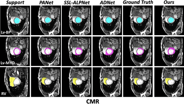 Figure 4 for Few-Shot Medical Image Segmentation via a Region-enhanced Prototypical Transformer