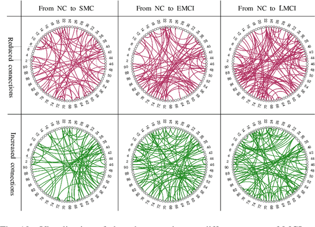 Figure 2 for Brain Structure-Function Fusing Representation Learning using Adversarial Decomposed-VAE for Analyzing MCI
