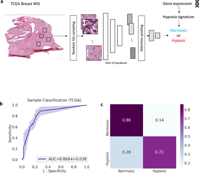 Figure 1 for Deep learning-based detection of morphological features associated with hypoxia in H&E breast cancer whole slide images