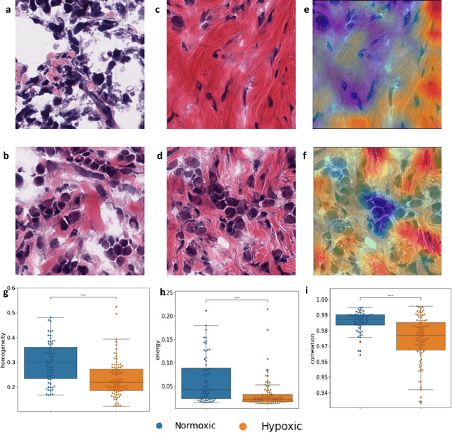Figure 2 for Deep learning-based detection of morphological features associated with hypoxia in H&E breast cancer whole slide images