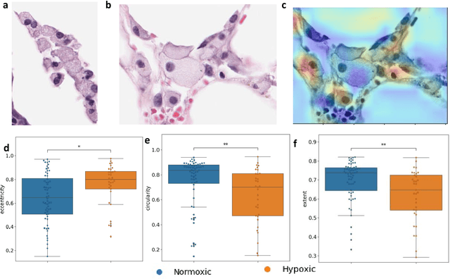 Figure 3 for Deep learning-based detection of morphological features associated with hypoxia in H&E breast cancer whole slide images