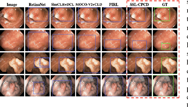 Figure 4 for SSL-CPCD: Self-supervised learning with composite pretext-class discrimination for improved generalisability in endoscopic image analysis
