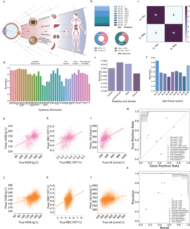 Figure 4 for VisionFM: a Multi-Modal Multi-Task Vision Foundation Model for Generalist Ophthalmic Artificial Intelligence
