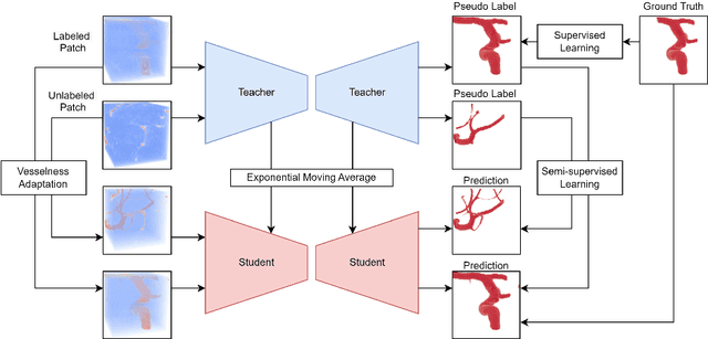 Figure 1 for Adaptive Semi-Supervised Segmentation of Brain Vessels with Ambiguous Labels
