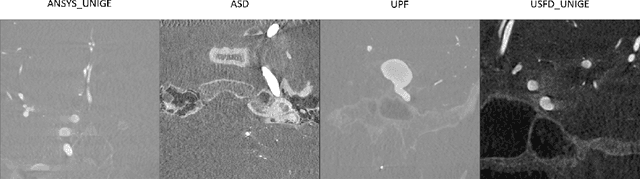 Figure 3 for Adaptive Semi-Supervised Segmentation of Brain Vessels with Ambiguous Labels