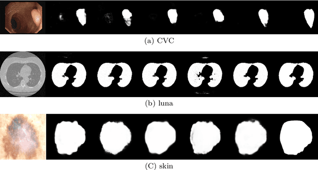 Figure 4 for Non-pooling Network for medical image segmentation