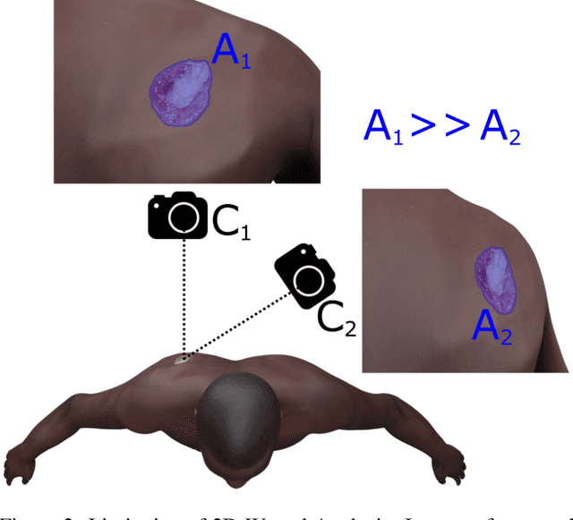 Figure 2 for SALVE: A 3D Reconstruction Benchmark of Wounds from Consumer-grade Videos