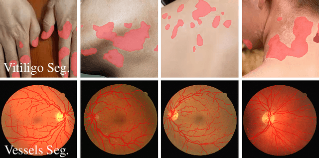 Figure 1 for Adaptive Frequency Domain Alignment Network for Medical image segmentation