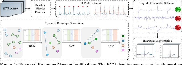 Figure 1 for Bilateral Signal Warping for Left Ventricular Hypertrophy Diagnosis