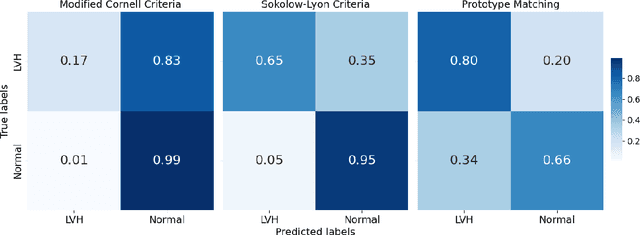Figure 4 for Bilateral Signal Warping for Left Ventricular Hypertrophy Diagnosis