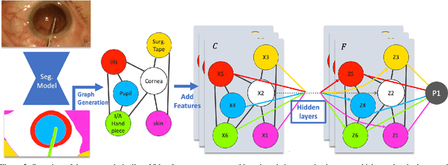 Figure 3 for Dynamic Scene Graph Representation for Surgical Video