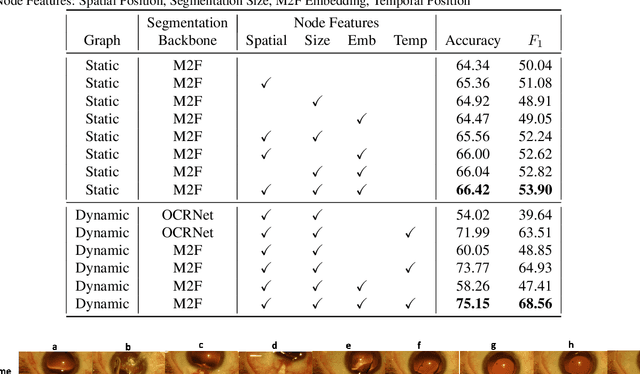 Figure 4 for Dynamic Scene Graph Representation for Surgical Video