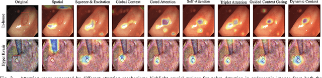 Figure 2 for Dynamic Contextual Attention Network: Transforming Spatial Representations into Adaptive Insights for Endoscopic Polyp Diagnosis