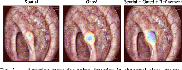 Figure 3 for Dynamic Contextual Attention Network: Transforming Spatial Representations into Adaptive Insights for Endoscopic Polyp Diagnosis