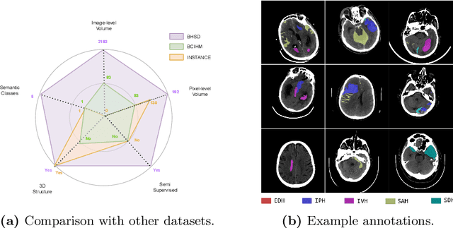 Figure 1 for BHSD: A 3D Multi-Class Brain Hemorrhage Segmentation Dataset