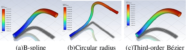 Figure 4 for Integrated and Lightweight Design of Electro-hydraulic Ankle Prosthesis