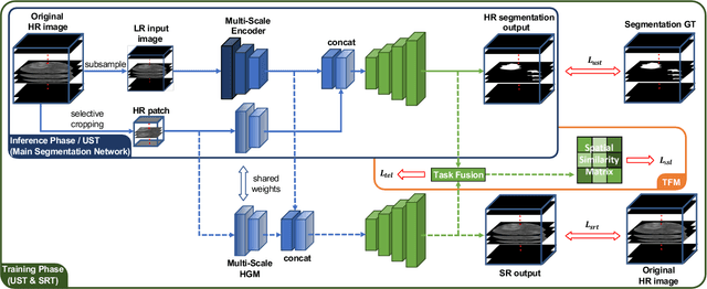 Figure 2 for Super-Resolution Based Patch-Free 3D Medical Image Segmentation with Self-Supervised Guidance