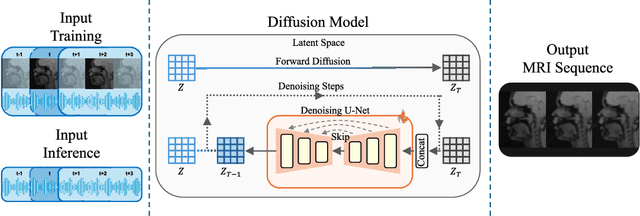 Figure 1 for A Speech-to-Video Synthesis Approach Using Spatio-Temporal Diffusion for Vocal Tract MRI