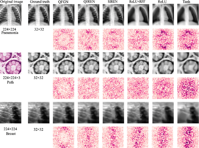 Figure 4 for QFGN: A Quantum Approach to High-Fidelity Implicit Neural Representations