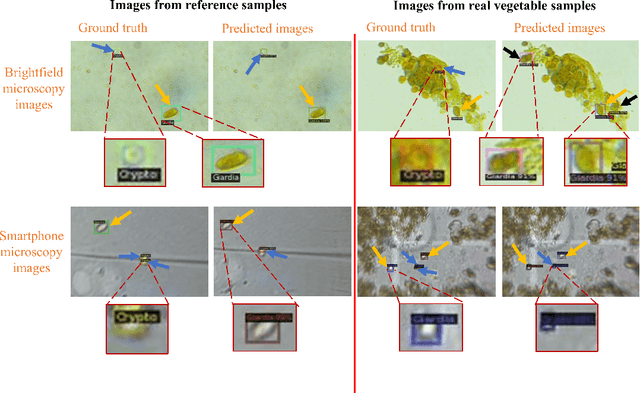 Figure 1 for Deep-learning assisted detection and quantification of (oo)cysts of Giardia and Cryptosporidium on smartphone microscopy images