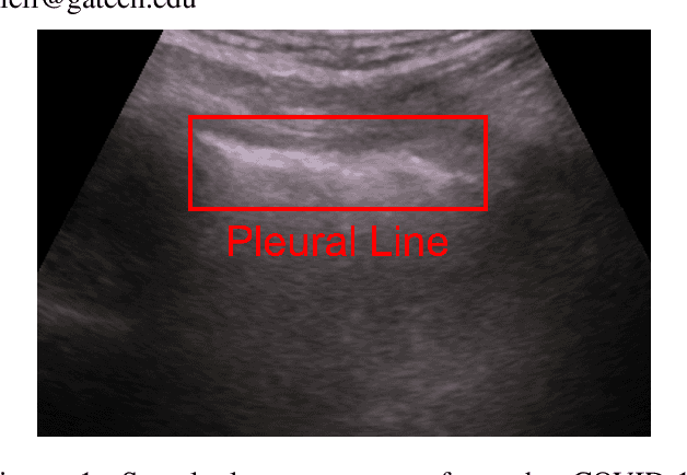 Figure 1 for MobilePTX: Sparse Coding for Pneumothorax Detection Given Limited Training Examples