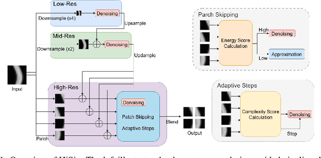 Figure 1 for HiSin: Efficient High-Resolution Sinogram Inpainting via Resolution-Guided Progressive Inference