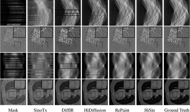 Figure 4 for HiSin: Efficient High-Resolution Sinogram Inpainting via Resolution-Guided Progressive Inference