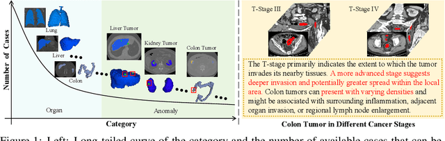 Figure 1 for CAT: Coordinating Anatomical-Textual Prompts for Multi-Organ and Tumor Segmentation