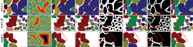 Figure 3 for DFGET: Displacement-Field Assisted Graph Energy Transmitter for Gland Instance Segmentation