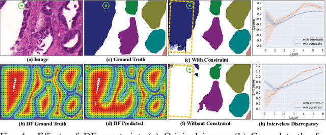 Figure 4 for DFGET: Displacement-Field Assisted Graph Energy Transmitter for Gland Instance Segmentation
