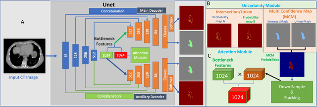 Figure 1 for Uncertainty Driven Bottleneck Attention U-net for OAR Segmentation