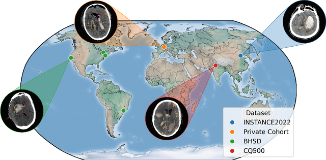 Figure 1 for Federated Voxel Scene Graph for Intracranial Hemorrhage