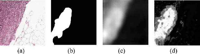 Figure 1 for Enhancing Weakly-Supervised Histopathology Image Segmentation with Knowledge Distillation on MIL-Based Pseudo-Labels