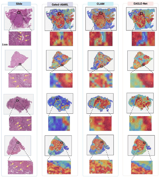 Figure 4 for The Next Layer: Augmenting Foundation Models with Structure-Preserving and Attention-Guided Learning for Local Patches to Global Context Awareness in Computational Pathology
