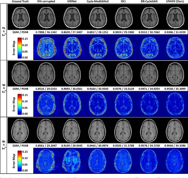 Figure 4 for UNAEN: Unsupervised Abnomality Extraction Network for MRI Motion Artifact Reduction