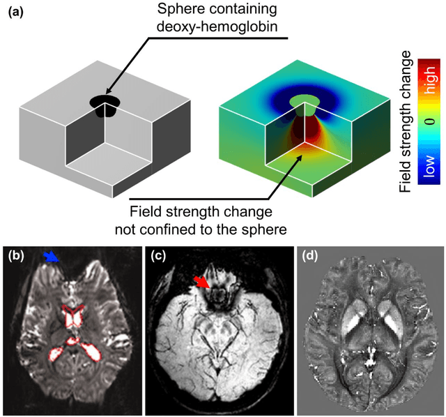 Figure 1 for So You Want to Image Myelin Using MRI: Advanced Magnetic Susceptibility Imaging for Myelin