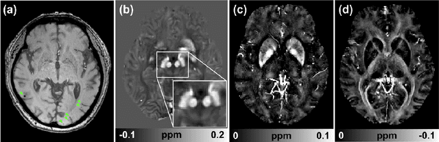 Figure 2 for So You Want to Image Myelin Using MRI: Advanced Magnetic Susceptibility Imaging for Myelin
