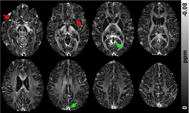 Figure 3 for So You Want to Image Myelin Using MRI: Advanced Magnetic Susceptibility Imaging for Myelin