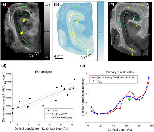 Figure 4 for So You Want to Image Myelin Using MRI: Advanced Magnetic Susceptibility Imaging for Myelin