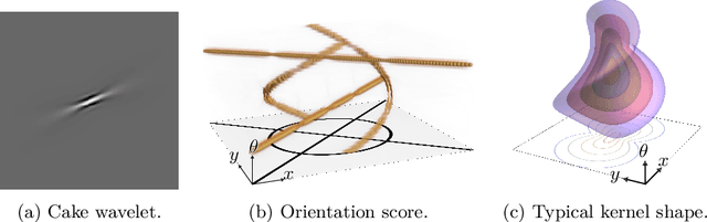 Figure 1 for Orientation Scores should be a Piece of Cake