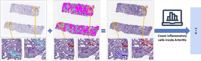 Figure 2 for How Close Are We? Limitations and Progress of AI Models in Banff Lesion Scoring