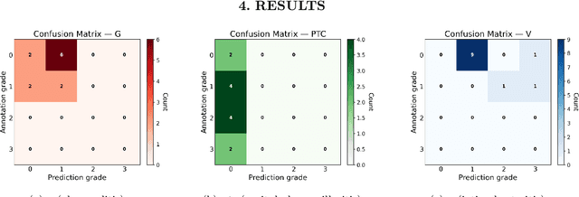 Figure 3 for How Close Are We? Limitations and Progress of AI Models in Banff Lesion Scoring