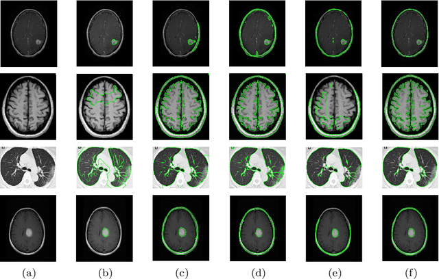Figure 1 for Robust image segmentation model based on binary level set